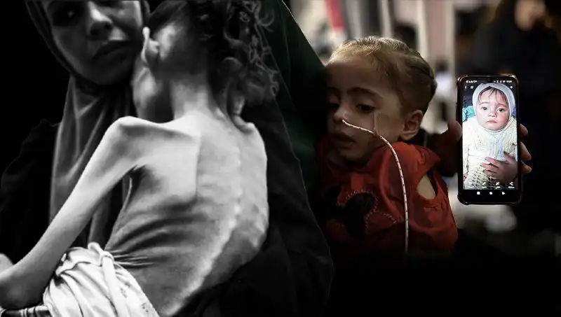 Büyüyen Rahatsızlık: Küçük Meryem Açlıkla Mücadele Ediyor