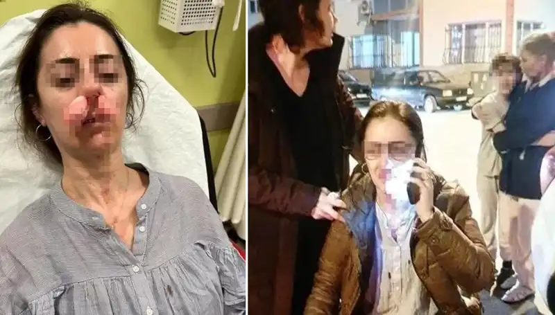 Bir Araç Kapısı Eşinin Sevgilisi Sanılarak Silah Haline Geldi!